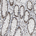 Immunohistochemical staining of human colon shows strong nuclear positivity in glandular cells.