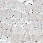 Immunohistochemical staining of human skeletal muscle shows strong nuclear positivity in myocytes.