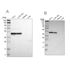 Western blot analysis using Anti-FAM98B antibody HPA008502 (A) shows similar pattern to independent antibody HPA008320 (B).