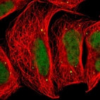 Immunofluorescent staining of human cell line A-431 shows localization to nucleoplasm & vesicles.