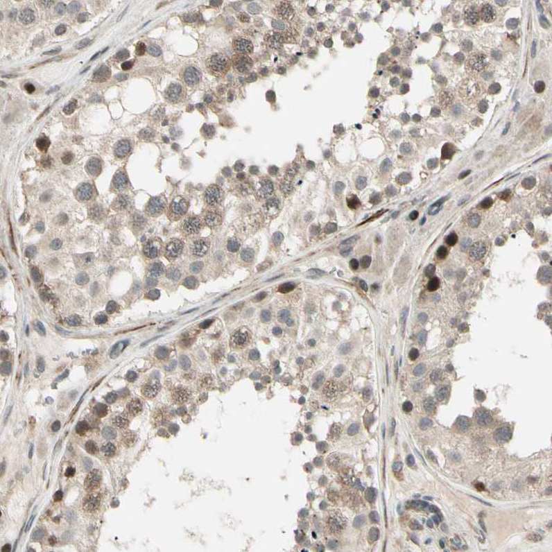 Anti-SVBP Antibody