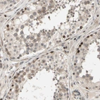Anti-SVBP Antibody