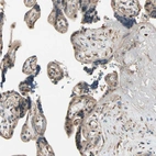 Immunohistochemical staining of human placenta shows weak to moderate nuclear positivity in a subset of trophoblastic cells.