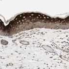 Immunohistochemical staining of human skin shows moderate to strong cytoplasmic positivity in squamous epithelial cells.