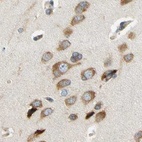 Immunohistochemical staining of human cerebral cortex using Anti-LRRC47 antibody HPA008512.