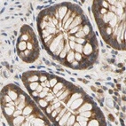 Immunohistochemical staining of human colon using Anti-LRRC47 antibody HPA008512.