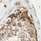 Immunohistochemical staining of human testis using Anti-LRRC47 antibody HPA008512.