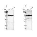 Western blot analysis using Anti-LRRC47 antibody HPA008512 (A) shows similar pattern to independent antibody HPA012018 (B).