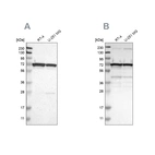 Western blot analysis using Anti-LRRC47 antibody HPA008512 (A) shows similar pattern to independent antibody HPA012018 (B).