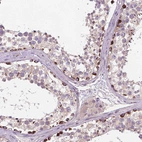 Immunohistochemical staining of human testis shows strong cytoplasmic positivity in spermatogonia.