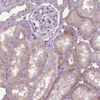 Immunohistochemical staining of human kidney shows weak cytoplasmic positivity in cells in tubules.