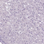 Immunohistochemical staining of human liver shows no positivity in hepatocytes.