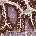 Immunohistochemical staining of human small intestine shows strong membranous positivity in glandular cells.