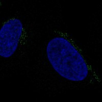 Anti-ALKBH7 Antibody