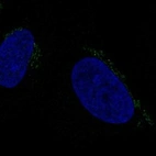 Anti-ALKBH7 Antibody