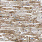 Immunohistochemical staining of human heart muscle shows moderate cytoplasmic positivity in cardiomyocytes.