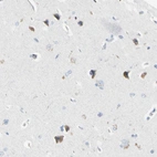 Immunohistochemical staining of human cerebral cortex shows weak cytoplasmic positivity in neurons.