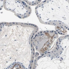 Immunohistochemical staining of human placenta shows moderate positivity in plasma.