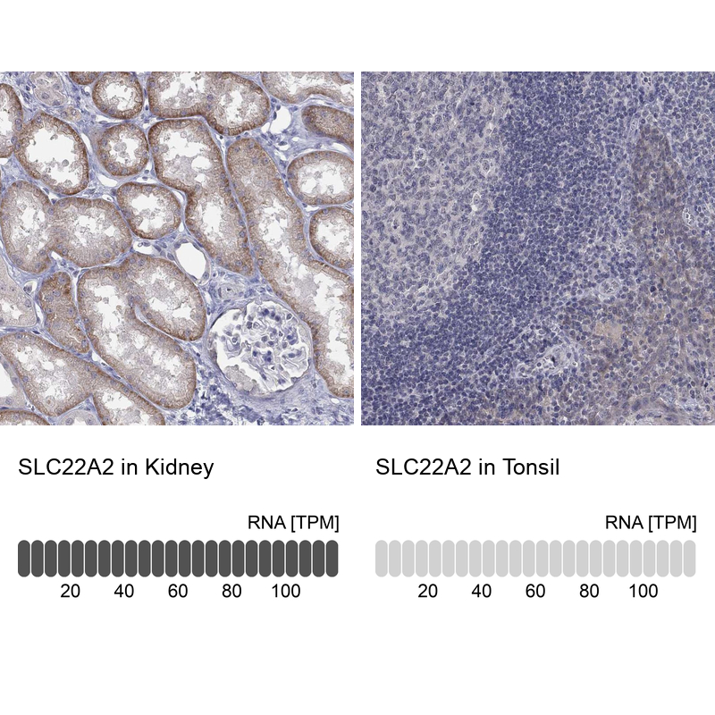 Anti-SLC22A2 Antibody