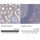 Anti-SLC22A2 Antibody