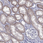 Anti-SLC22A2 Antibody
