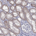Immunohistochemical staining of human kidney shows high expression.