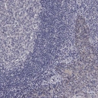 Immunohistochemical staining of human tonsil shows low expression as expected.