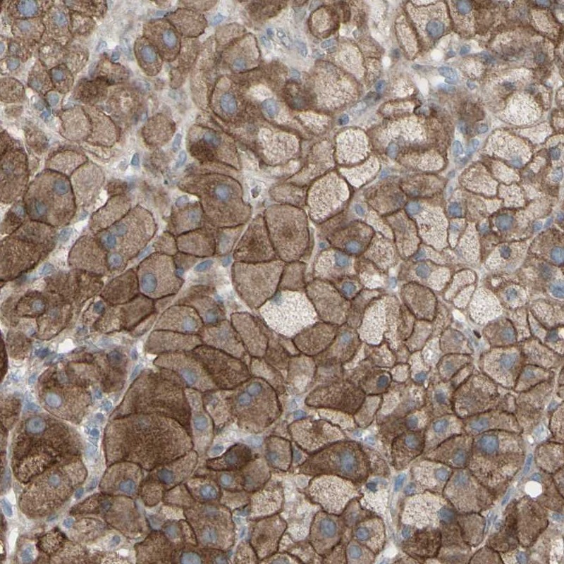 Anti-GRAMD1B Antibody