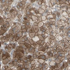 Anti-GRAMD1B Antibody