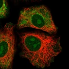 Immunofluorescent staining of human cell line A549 shows localization to nucleoli & intermediate filaments.