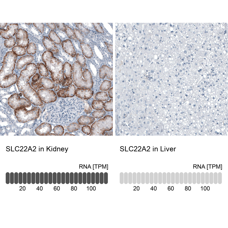 Anti-SLC22A2 Antibody