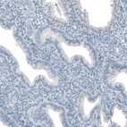 Immunohistochemical staining of human endometrium shows no positivity in glandular cells as expected.