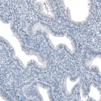 Immunohistochemical staining of human endometrium shows no positivity in glandular cells as expected.