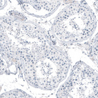 Immunohistochemical staining of human testis shows no positivity in cells in seminiferous ducts as expected.
