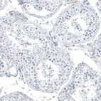 Immunohistochemical staining of human testis shows no positivity in cells in seminiferous ducts as expected.