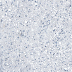 Immunohistochemical staining of human liver shows no positivity in hepatocytes as expected.