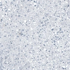 Immunohistochemical staining of human liver shows no positivity in hepatocytes as expected.