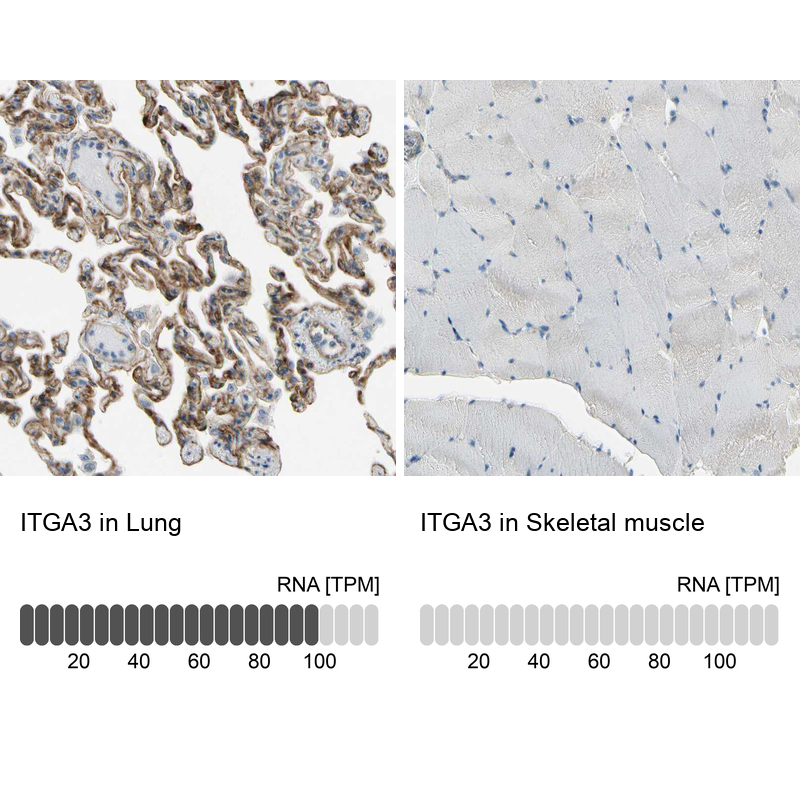 Anti-ITGA3 Antibody