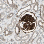 Immunohistochemical staining of human kidney shows strong membranous positivity in cells in glomeruli.