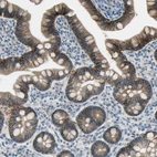 Immunohistochemical staining of human small intestine shows strong membranous positivity in glandular cells.