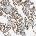 Immunohistochemical staining of human lung shows strong membranous positivity in pneumocytes.