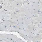 Immunohistochemical staining of human skeletal muscle shows no positivity in myocytes as expected.