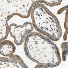 Anti-IGDCC4 Antibody