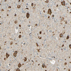 Anti-IGDCC4 Antibody