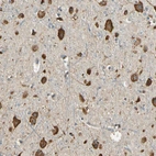 Immunohistochemical staining of human cerebral cortex shows positivity in neuronal cells.
