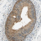 Immunohistochemical staining of human epididymis shows cytoplasmic positivity in glandular cells.