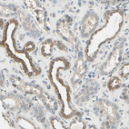 Immunohistochemical staining of human kidney shows cytoplasmic positivity in cells in tubules.