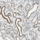 Immunohistochemical staining of human kidney shows cytoplasmic positivity in cells in tubules.