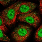 Immunofluorescent staining of human cell line A549 shows localization to nucleoplasm & cytosol.
