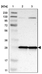 Lane 1: Marker [kDa] 230, 130, 95, 72, 56, 36, 28, 17, 11_br/_Lane 2: Human cell line RT-4_br/_Lane 3: Human cell line U-251MG sp